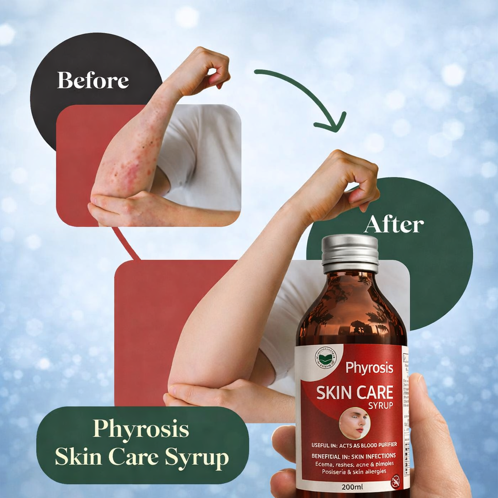 Phyrosis Skin Care Herbal Syrup – Natural Relief for Psoriasis & Eczema
